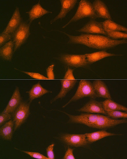 PP1 beta Rabbit mAb