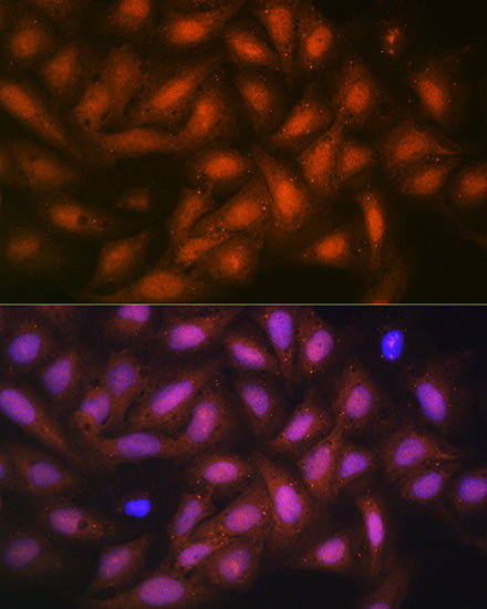 PP1 beta Rabbit mAb
