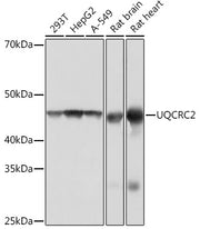 UQCRC2 Rabbit mAb