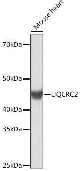 UQCRC2 Rabbit mAb