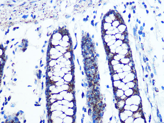 UQCRC2 Rabbit mAb