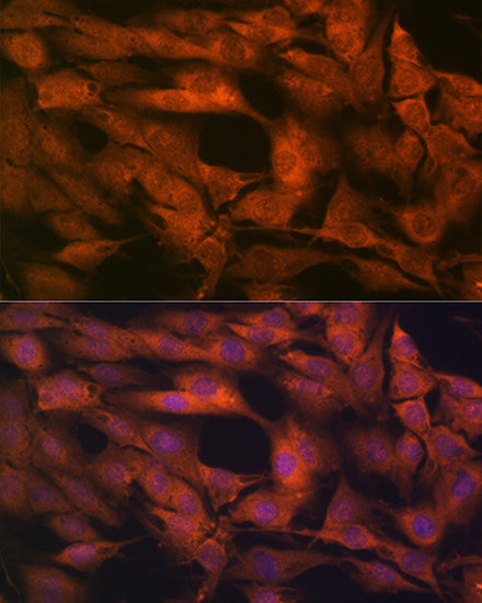 Laminin beta 1 Rabbit mAb