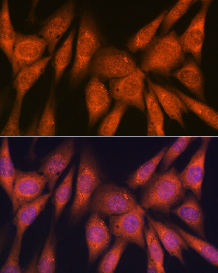 Laminin beta 1 Rabbit mAb