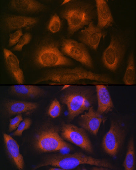 Laminin beta 1 Rabbit mAb