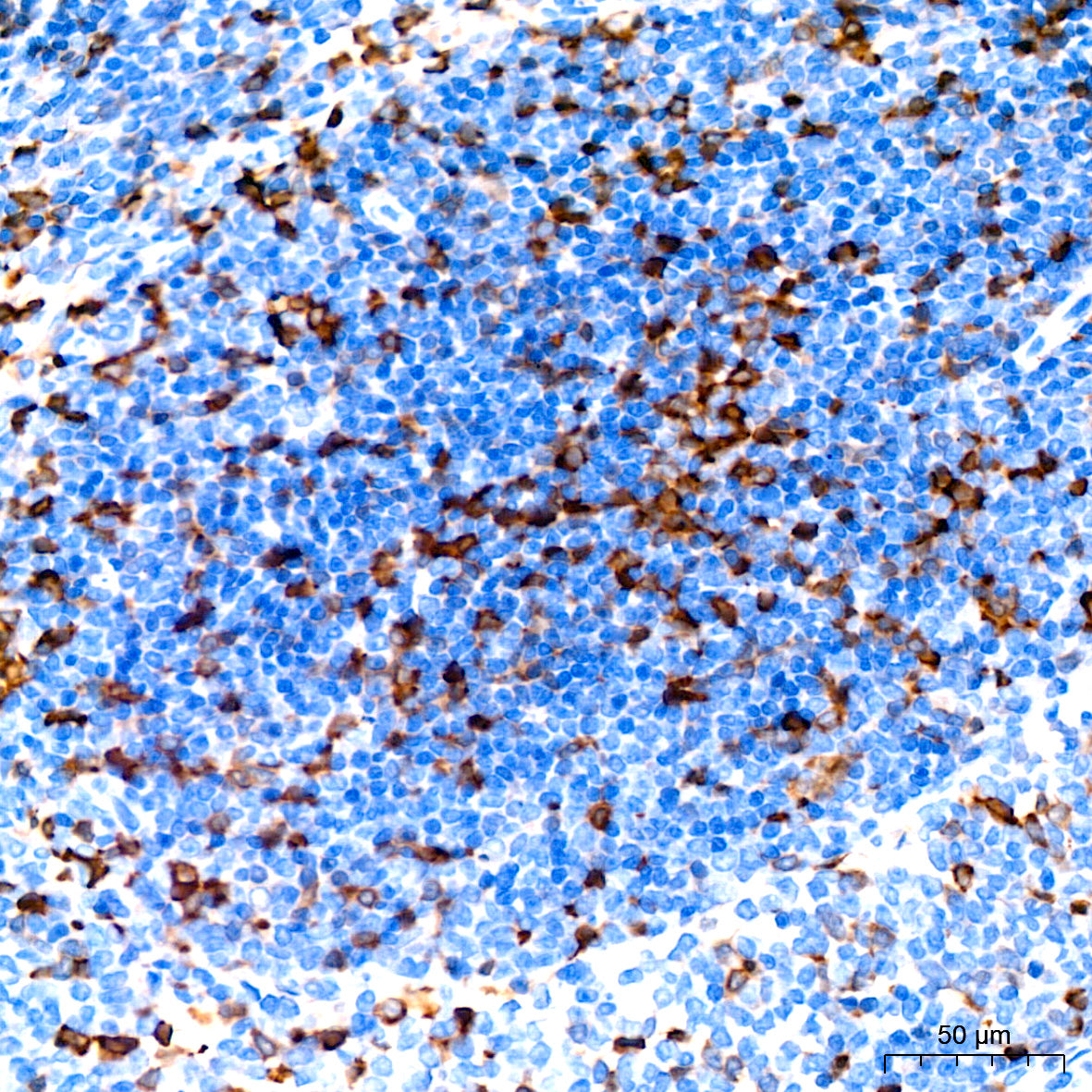 Stathmin 1 Rabbit mAb