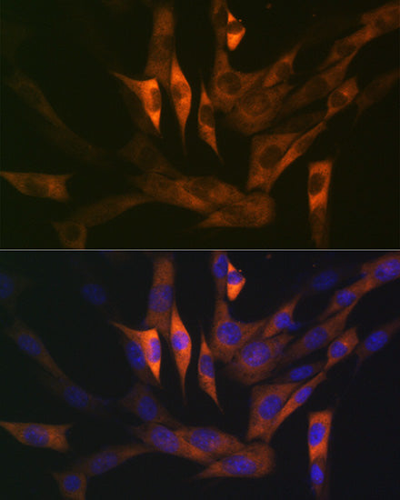 Stathmin 1 Rabbit mAb