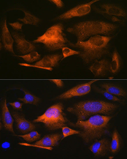 Stathmin 1 Rabbit mAb
