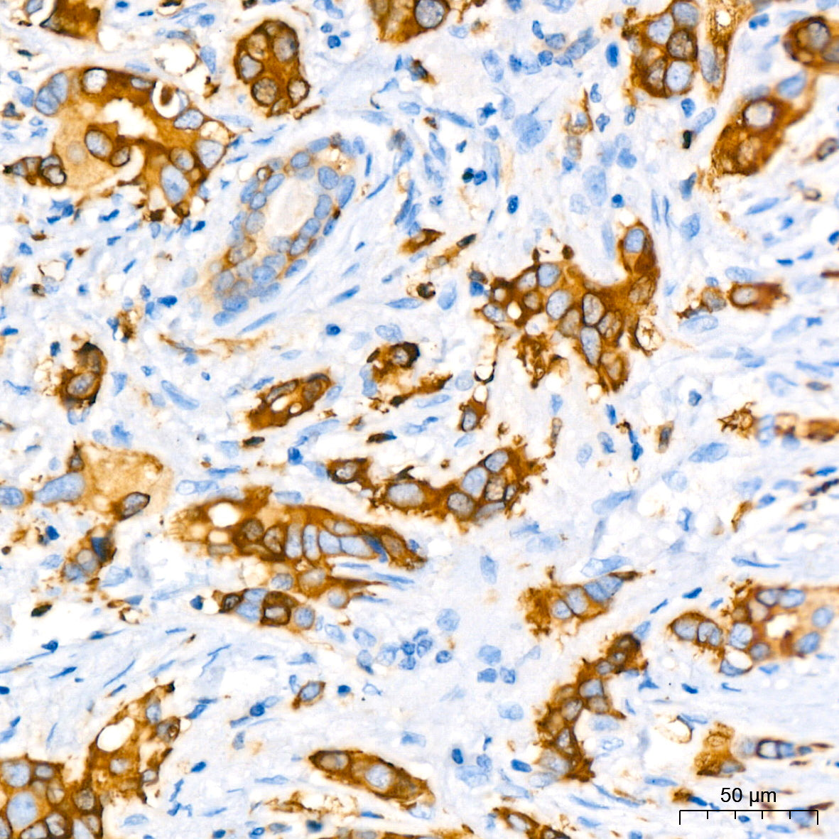 Stathmin 1 Rabbit mAb
