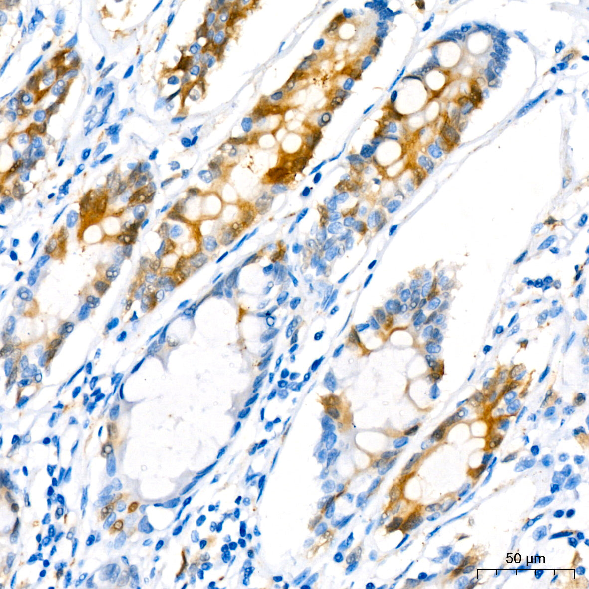 Stathmin 1 Rabbit mAb