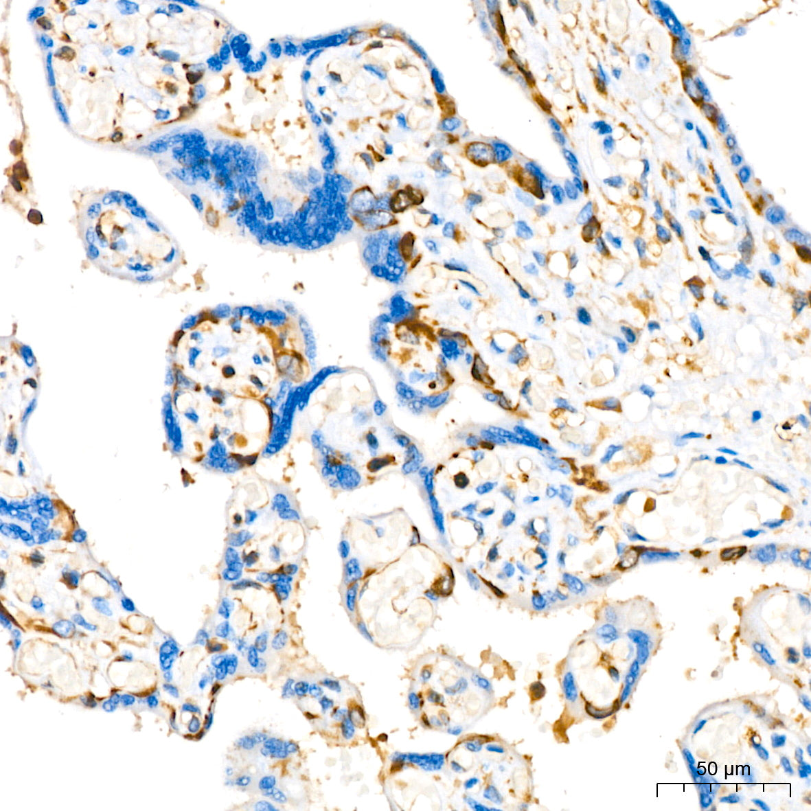 Stathmin 1 Rabbit mAb