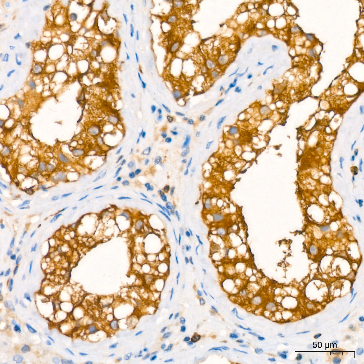 Stathmin 1 Rabbit mAb
