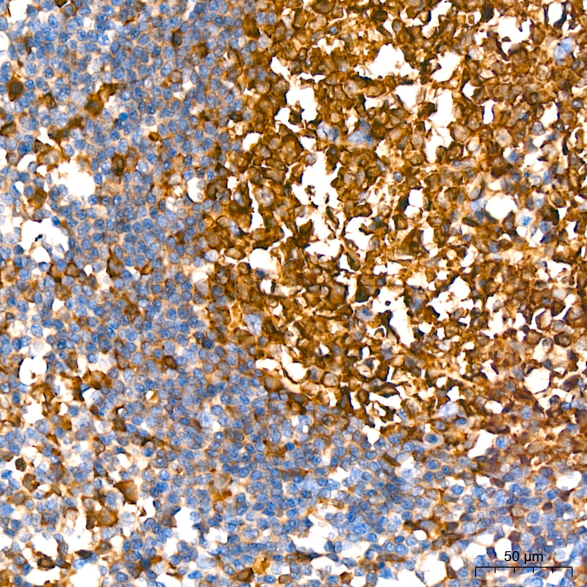 Stathmin 1 Rabbit mAb