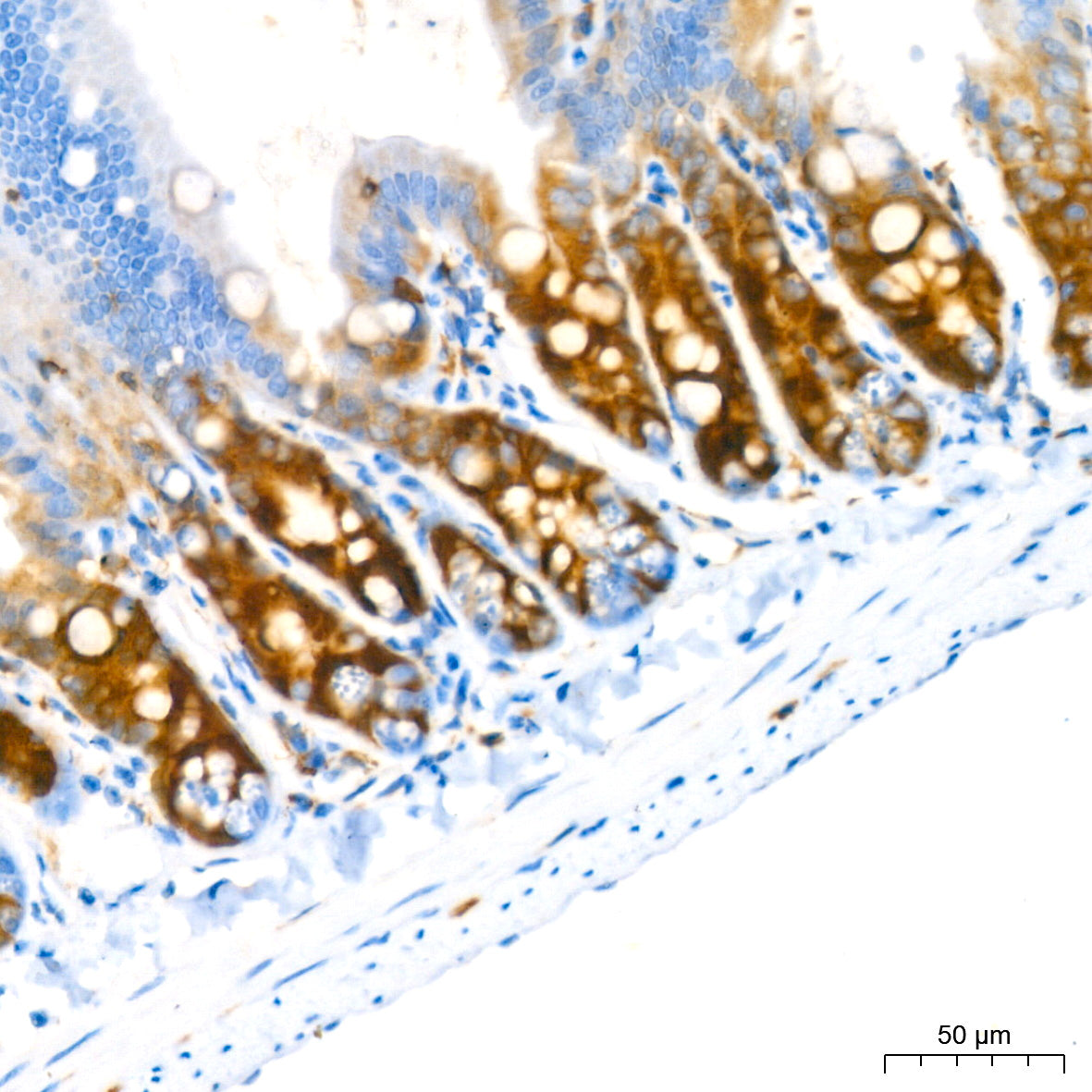 Stathmin 1 Rabbit mAb