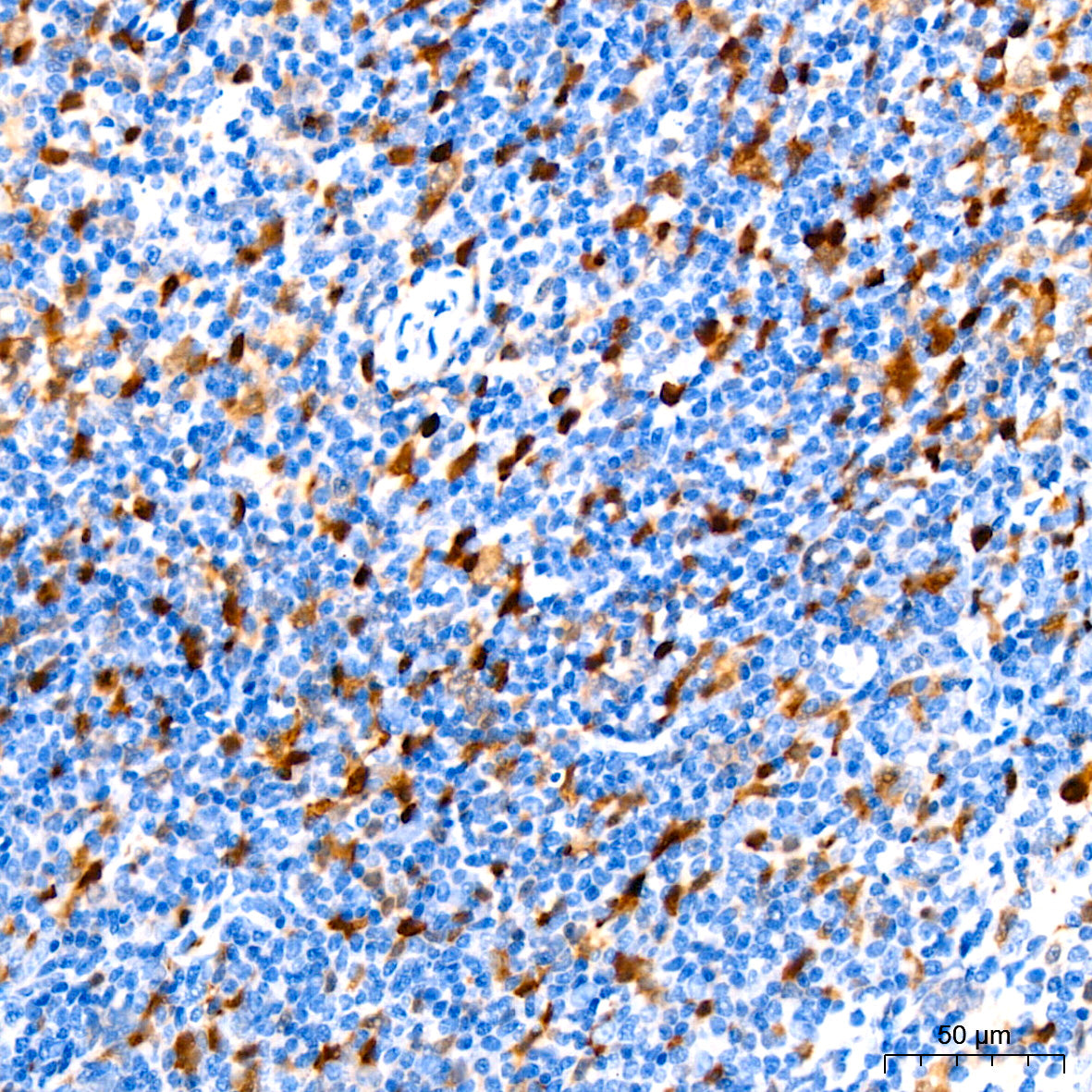 Stathmin 1 Rabbit mAb