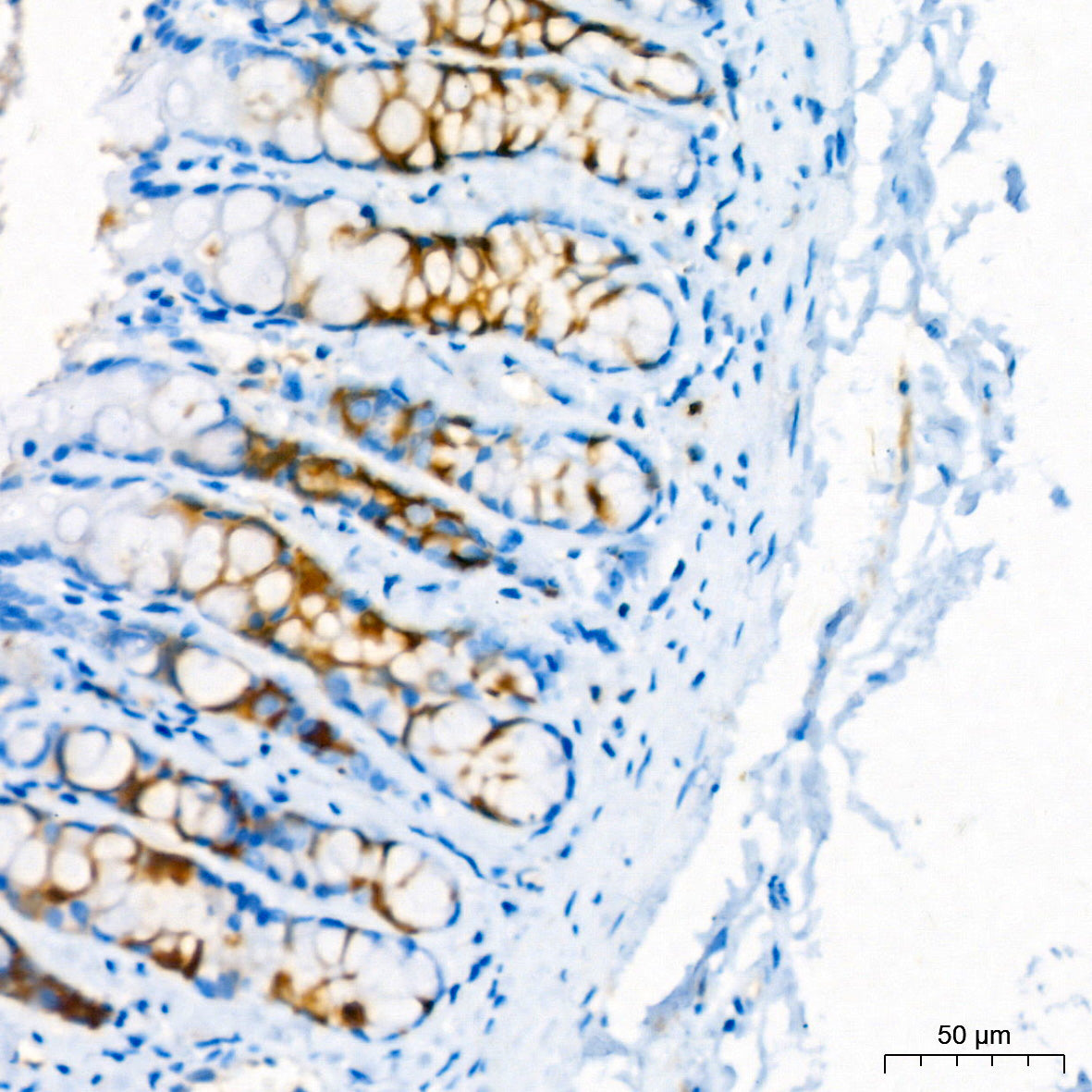 Stathmin 1 Rabbit mAb