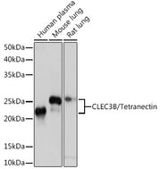 CLEC3B/Tetranectin Rabbit mAb