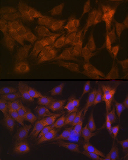 CLEC3B/Tetranectin Rabbit mAb