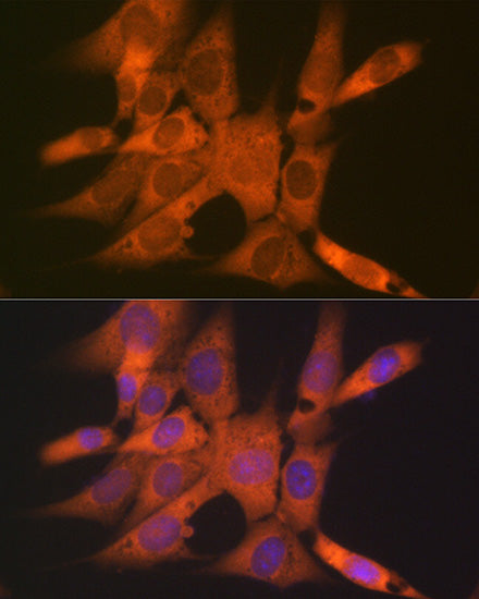 CLEC3B/Tetranectin Rabbit mAb