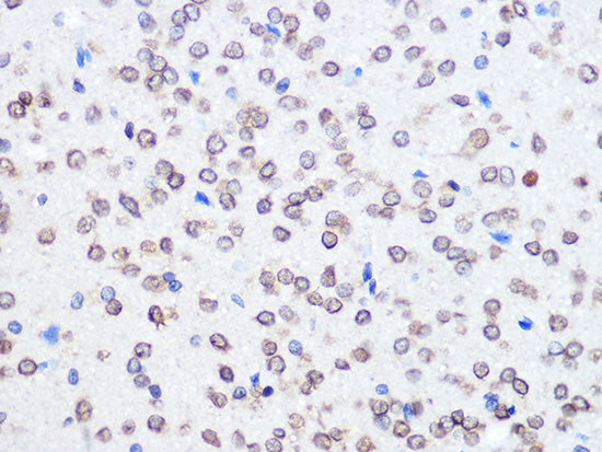 UBE2I Rabbit mAb