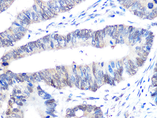 UBE2I Rabbit mAb