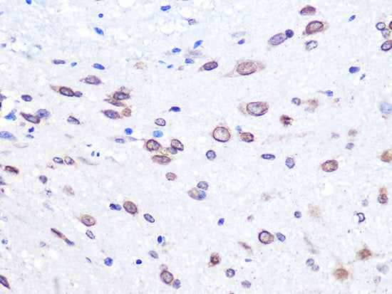 UBE2I Rabbit mAb