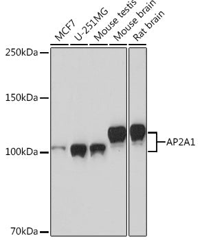 AP2A1 Rabbit mAb