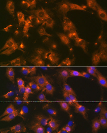 AP2A1 Rabbit mAb