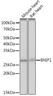 BNIP1 Rabbit mAb