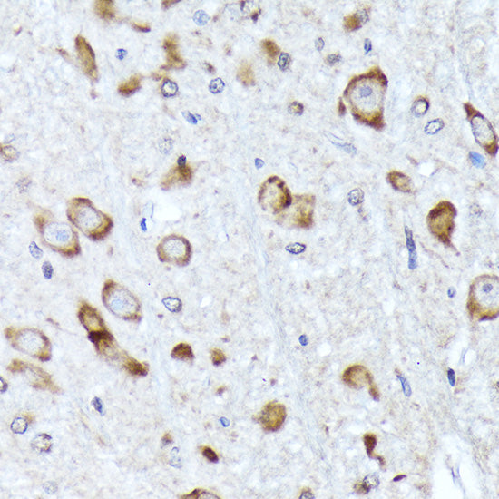 BNIP1 Rabbit mAb