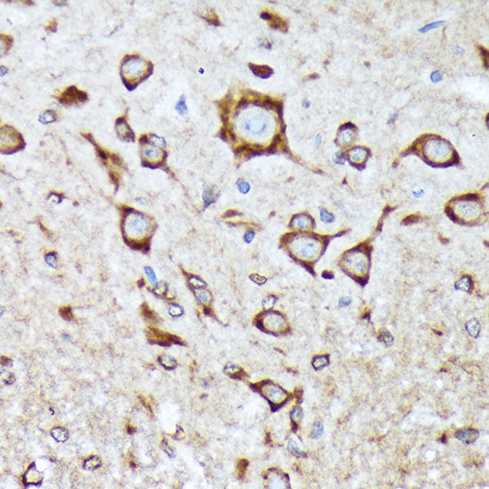 BNIP1 Rabbit mAb