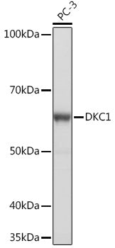 DKC1 Rabbit mAb
