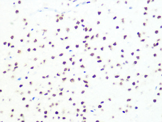 DKC1 Rabbit mAb