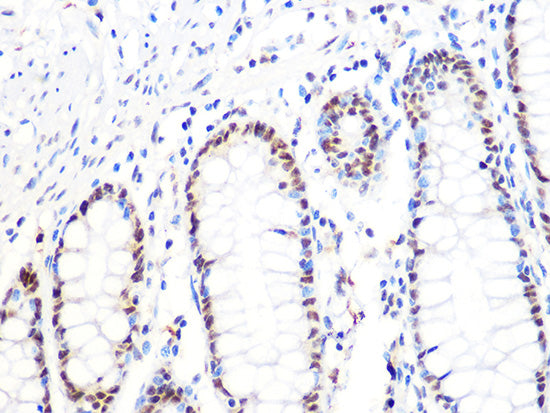 DKC1 Rabbit mAb