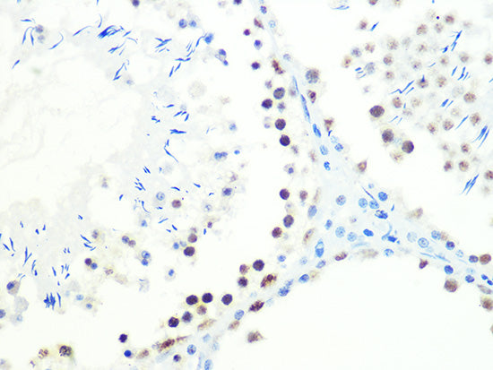 DKC1 Rabbit mAb