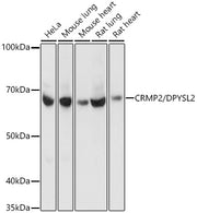 [KO Validated] CRMP2/DPYSL2 Rabbit mAb