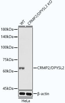 [KO Validated] CRMP2/DPYSL2 Rabbit mAb