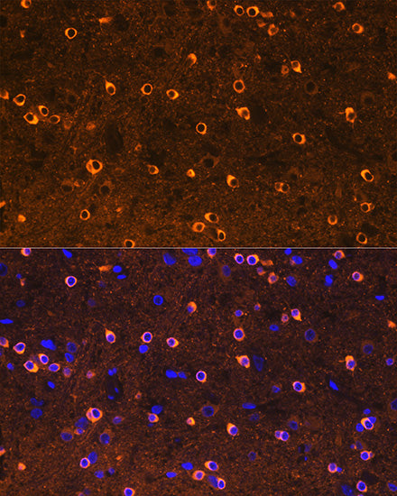 [KO Validated] CRMP2/DPYSL2 Rabbit mAb