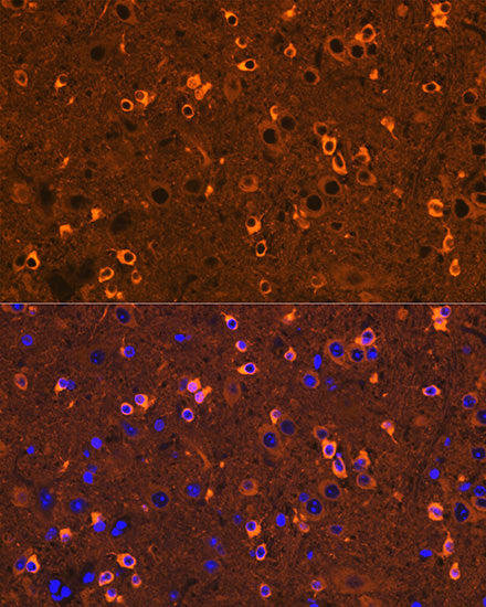 [KO Validated] CRMP2/DPYSL2 Rabbit mAb