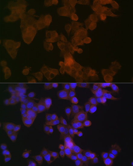 APOL1 Rabbit mAb