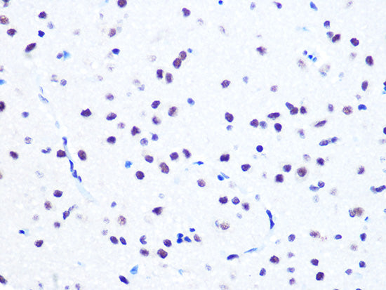NUMA1 Rabbit mAb
