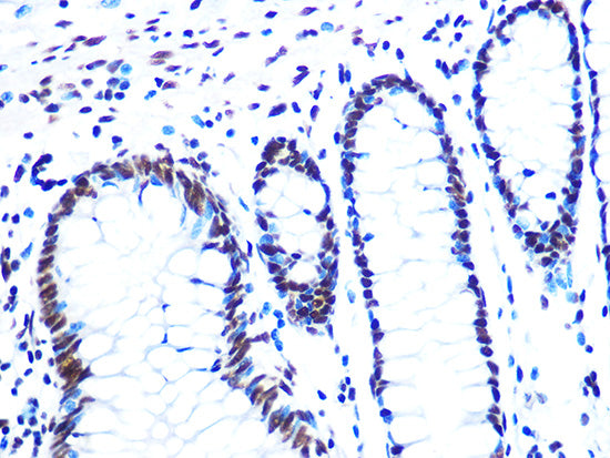NUMA1 Rabbit mAb