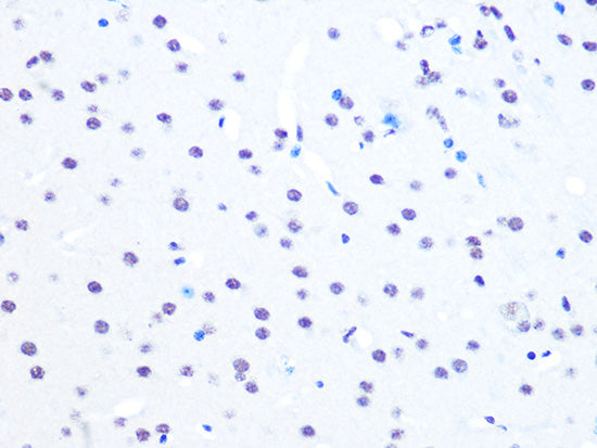 NUMA1 Rabbit mAb