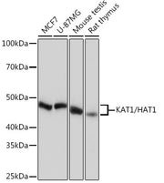 [KO Validated] KAT1/HAT1 Rabbit mAb