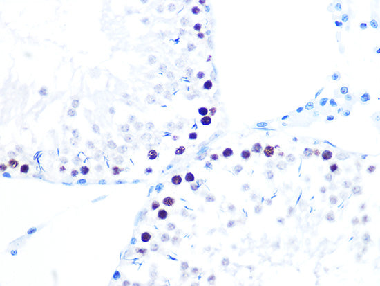 [KO Validated] KAT1/HAT1 Rabbit mAb