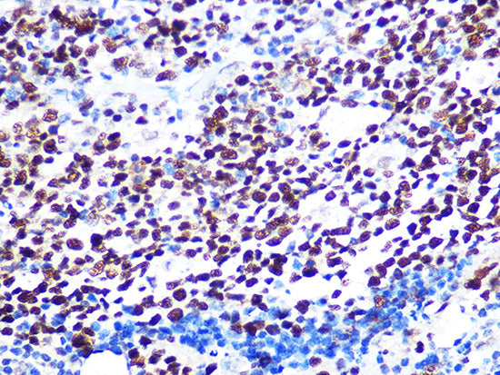 [KO Validated] KAT1/HAT1 Rabbit mAb