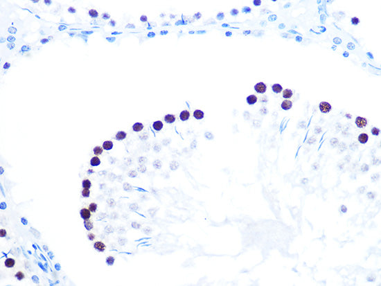 [KO Validated] KAT1/HAT1 Rabbit mAb
