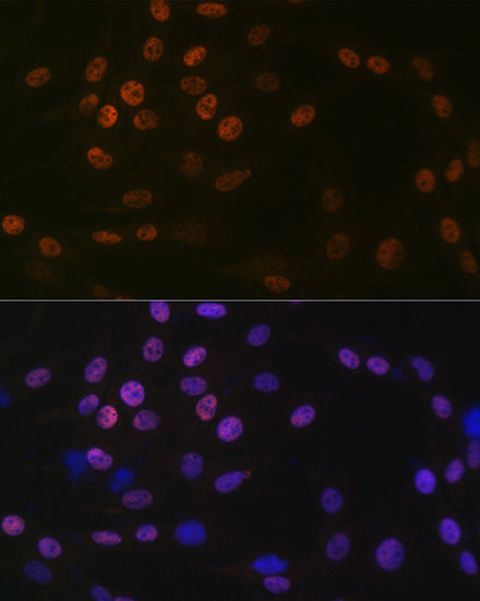 [KO Validated] KAT1/HAT1 Rabbit mAb