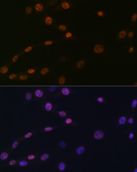 [KO Validated] KAT1/HAT1 Rabbit mAb