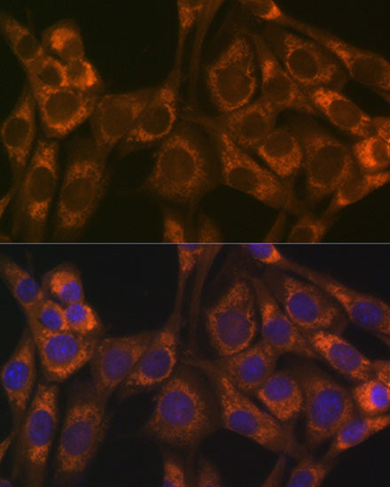 Thioredoxin 2 (Trx2/TXN2) Rabbit mAb