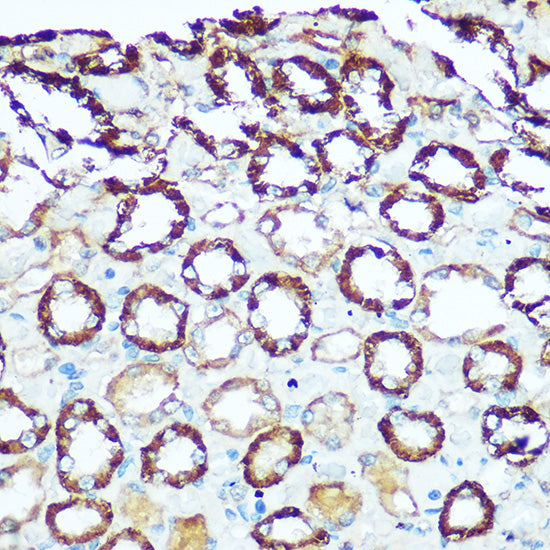 ATP5H Rabbit pAb